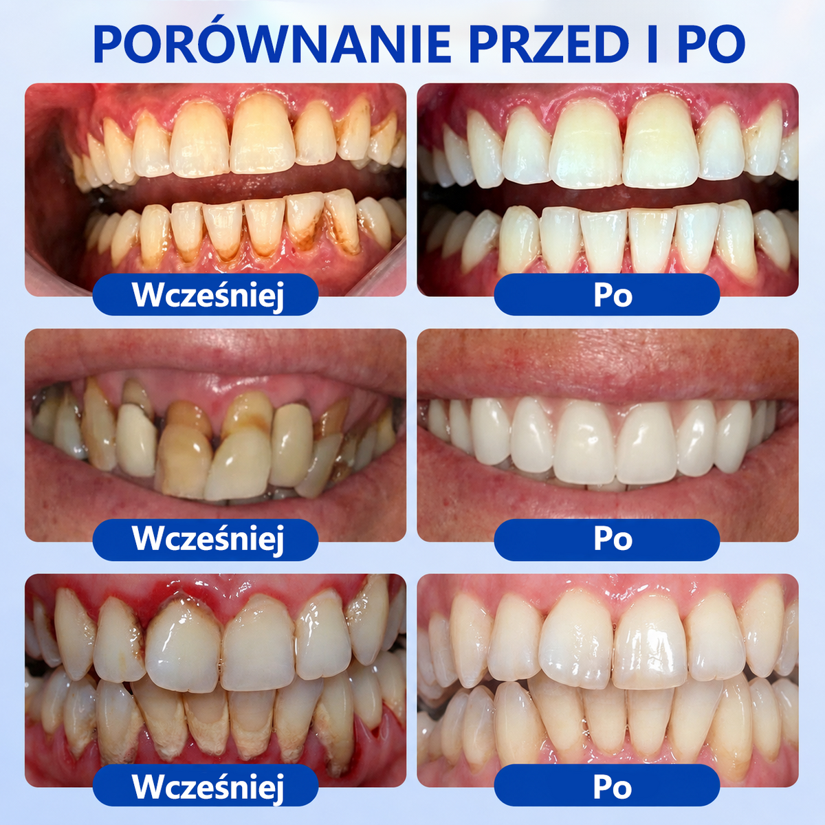 🎁Ostatnie 5 sztuk! Dodaj do koszyka i zyskaj 70% rabatu!