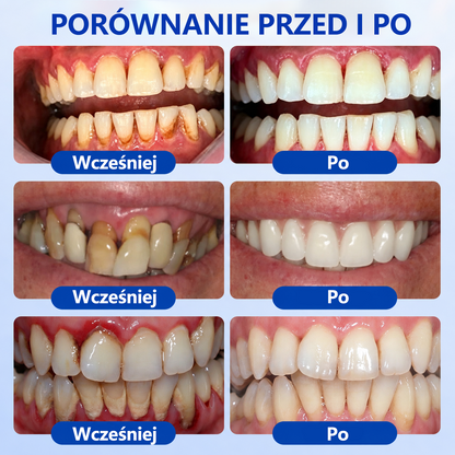 🎁Ostatnie 5 sztuk! Dodaj do koszyka i zyskaj 70% rabatu!
