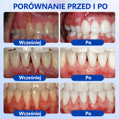 🎁Ostatnie 5 sztuk! Dodaj do koszyka i zyskaj 70% rabatu!