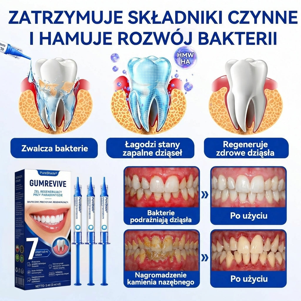 🎁Ostatnie 5 sztuk! Dodaj do koszyka i zyskaj 70% rabatu!