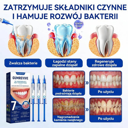 🎁Ostatnie 5 sztuk! Dodaj do koszyka i zyskaj 70% rabatu!